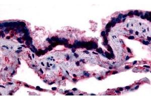 Human Respiratory Epithelium, Bronchial Smooth Muscle, and Alveoli (formalin-fixed, paraffin-embedded) stained with CAV1 antibody ABIN213407 at 15-20 ug/ml followed by biotinylated goat anti-rabbit IgG secondary antibody ABIN481713, alkaline phosphatase-str . (Caveolin-1 antibody  (N-Term))
