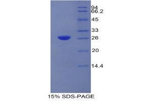 SDS-PAGE (SDS) image for Carcinoembryonic Antigen Gene Family (CEA) (AA 544-771) protein (His tag) (ABIN1980683)
