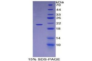 SDS-PAGE (SDS) image for Apolipoprotein B (APOB) (AA 3360-3526) protein (His tag) (ABIN1078867)