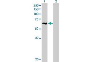 Western Blot analysis of TBRG4 expression in transfected 293T cell line by TBRG4 MaxPab polyclonal antibody. (TBRG4 antibody  (AA 1-631))
