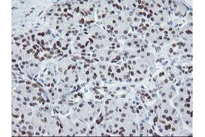 Image no. 2 for anti-Meis Homeobox 3 (MEIS3) (AA 1-261) antibody (ABIN1490671) (MEIS3 antibody  (AA 1-261))