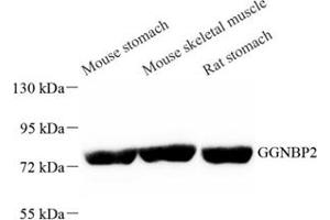 GGNBP2 anticorps