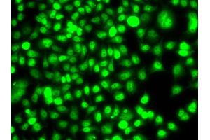 Immunofluorescence analysis of A549 cells using ETS2 antibody. (ETS2 antibody)