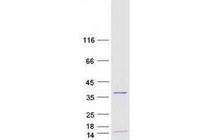 Validation with Western Blot (RPA4 Protein (Myc-DYKDDDDK Tag))