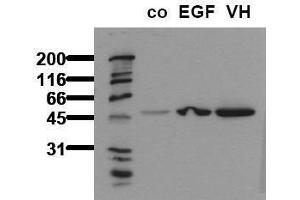 Western Blotting (WB) image for anti-Glycogen Synthase Kinase 3 alpha (GSK3a) (pSer21) antibody (ABIN126804)