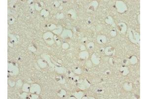 Immunohistochemistry of paraffin-embedded human brain tissue using ABIN7154206 at dilution of 1:100 (PYGB antibody  (AA 6-843))