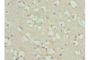 Immunohistochemistry of paraffin-embedded human brain tissue using ABIN7154206 at dilution of 1:100 (PYGB antibody  (AA 6-843))