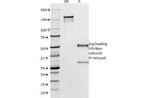 SDS-PAGE Analysis Purified IgG Mouse Monoclonal Antibody (IG266). (IGHG antibody  (CF®488A))