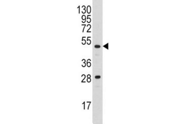 PLAU anticorps  (AA 60-90)