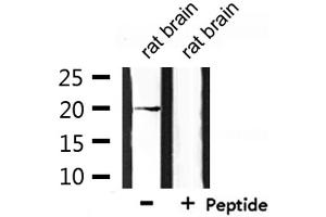 Western blot analysis of extracts from rat brain, using RGS10 Antibody. (RGS10 antibody  (Internal Region))