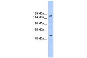 Image no. 1 for anti-SNF2 Histone Linker PHD RING Helicase, E3 Ubiquitin Protein Ligase (SHPRH) (AA 251-300) antibody (ABIN6742697) (SHPRH antibody  (AA 251-300))