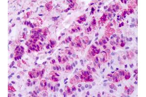 Anti-SLC1 / MCHR1 antibody IHC of human adrenal. (MCHR1 antibody  (N-Term))