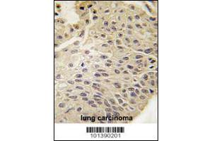 Immunohistochemistry (IHC) image for anti-Gap Junction Protein, beta 5, 31,1kDa (GJB5) (AA 89-119) antibody (ABIN5534074)