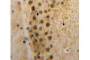 Used in DAB staining on fromalin fixed paraffin-embedded Brain tissue (Axin antibody  (AA 653-862))