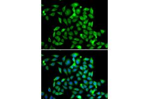 Immunofluorescence analysis of A549 cells using CLASP1 antibody (ABIN5974258). (CLASP1 antibody)