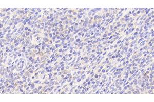 Detection of POLg1 in Human Spleen Tissue using Polyclonal Antibody to Polymerase DNA Directed Gamma 1 (POLg1) (POLG antibody  (AA 1041-1239))