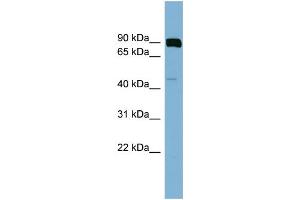 WB Suggested Anti-PSEN1  Antibody Titration: 0. (Presenilin 1 antibody  (N-Term))