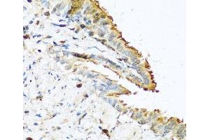 Immunohistochemistry of paraffin-embedded Mouse lung using RNASE13 Polyclonal Antibody at dilution of 1:100 (40x lens).