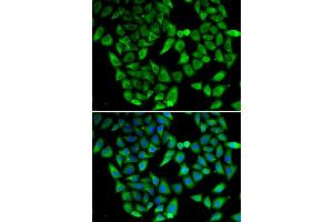 Immunofluorescence analysis of HeLa cells using ASIP antibody (ABIN6291269). (ASIP antibody)