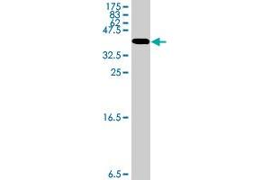 Western Blot detection against Immunogen (34. (SLC1A2 antibody  (AA 160-239))