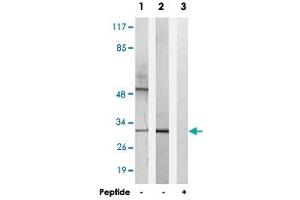 Western blot analysis of extracts from K-562 cells (Lane 1) and RAW 264.