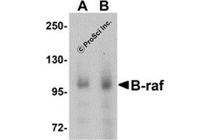 Western Blotting (WB) image for anti-Small Nuclear Ribonucleoprotein Polypeptide E (SNRPE) (Middle Region) antibody (ABIN1030878)