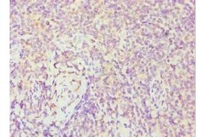 Immunohistochemistry of paraffin-embedded human tonsil tissue using ABIN7174019 at dilution of 1:100 (FES antibody  (AA 120-420))