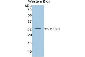 Western Blotting (WB) image for anti-Coagulation Factor VIII-Associated 1 (F8A1) (AA 171-375) antibody (ABIN1858769)