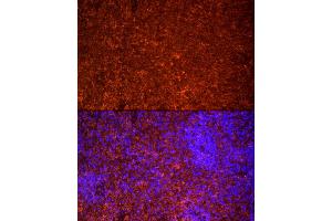 Immunofluorescence analysis of rat spleen cells using TLR7 Rabbit pAb (ABIN3021246, ABIN3021247, ABIN3021248 and ABIN6214083) at dilution of 1:25 (40x lens). (TLR7 antibody  (AA 30-230))