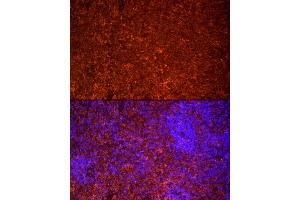 Immunofluorescence analysis of rat spleen cells using TLR7 Rabbit pAb (ABIN3021246, ABIN3021247, ABIN3021248 and ABIN6214083) at dilution of 1:25 (40x lens). (TLR7 antibody  (AA 30-230))