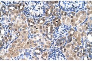 Human kidney (SLC46A3 antibody  (N-Term))