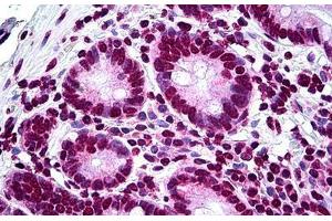 Human Small Intestine: Formalin-Fixed, Paraffin-Embedded (FFPE) (LHX1 antibody  (AA 1-101))