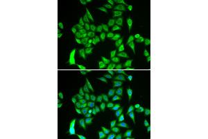 Immunofluorescence analysis of A549 cells using IREB2 antibody (ABIN6292155). (IREB2 antibody)
