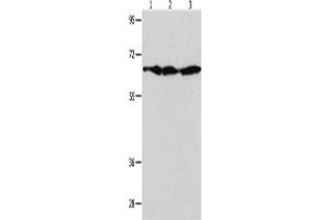 Western Blotting (WB) image for anti-Apoptosis-Inducing Factor, Mitochondrion-Associated, 1 (AIFM1) antibody (ABIN2421149) (AIF antibody)