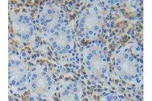 Detection of TREM1 in Human Stomach Tissue using Polyclonal Antibody to Triggering Receptor Expressed On Myeloid Cells 1 (TREM1) (TREM1 antibody  (AA 21-205))