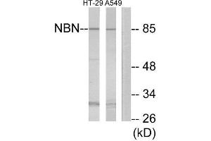 Western Blotting (WB) image for anti-Nibrin (NBN) (Internal Region) antibody (ABIN1850486) (Nibrin antibody  (Internal Region))
