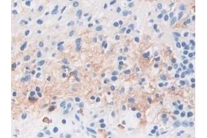 Immunohistochemistry (IHC) image for anti-Tubulin Polymerization Promoting Protein (Tppp) (AA 8-210) antibody (ABIN7439996)