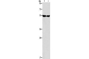 Western Blotting (WB) image for anti-Integrin-Linked Kinase (ILK) antibody (ABIN2428282) (ILK antibody)