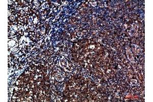 Immunohistochemical analysis of paraffin-embedded human-tonsil, antibody was diluted at 1:200 (CYFIP2 antibody  (AA 1171-1220))