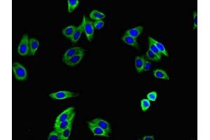 Immunofluorescence staining of HepG2 cells with ABIN7171957 at 1:400, counter-stained with DAPI. (TGFBR1 antibody  (AA 157-244))