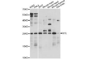 Western blot analysis of extracts of various cell lines, using RPE antibody.