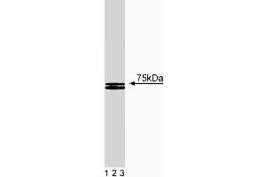 Western blot analysis of HS1 on human endothelial lysate. (HCLS1 antibody  (AA 17-190))