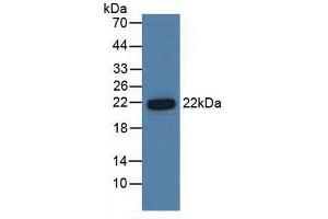 Detection of PSMb6 in Human Hela Cells using Polyclonal Antibody to Proteasome Subunit Beta Type 6 (PSMb6) (PSMB6 antibody  (AA 2-239))