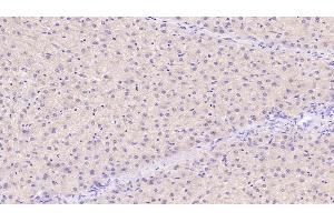 Detection of TIMP1 in Human Liver Tissue using Monoclonal Antibody to Tissue Inhibitors Of Metalloproteinase 1 (TIMP1) (TIMP1 antibody  (AA 25-207))