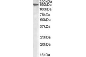 Western Blotting (WB) image for anti-Mannosidase, Alpha, Class 2A, Member 1 (MAN2A1) (Internal Region) antibody (ABIN2465922) (alpha-Mannosidase II antibody  (Internal Region))