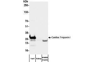 Western Blotting (WB) image for anti-Cardiac Troponin I (TNNI3) antibody (ABIN7795608) (TNNI3 antibody)