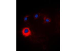 Immunofluorescent analysis of NOTCH1 staining in HeLa cells. (Notch1 antibody  (Center))