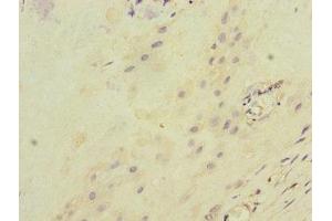 Immunohistochemistry of paraffin-embedded human placenta tissue using ABIN7156500 at dilution of 1:100 (ITGB8 antibody  (AA 43-320))