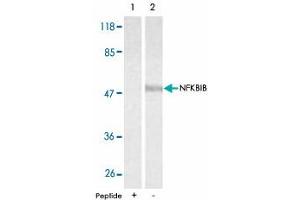 Western blot analysis of extracts from 293 cells using NFKBIB polyclonal antibody . (NFKBIB antibody)