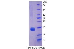 SDS-PAGE (SDS) image for Myoglobin (MB) (AA 1-154) protein (His tag) (ABIN1080355)